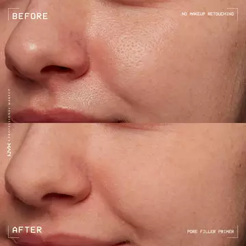 PORE FILLER