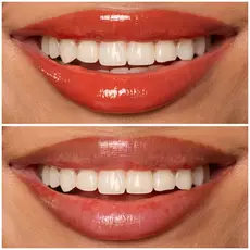 12 BURST THAT TANG! shade of Lip I.V. Hydrating Lip Gloss Stain for both shine and stain.
