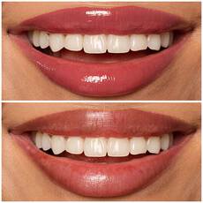 08 DRIPPIN IN ROSE shade of Lip I.V. Hydrating Lip Gloss Stain for both shine and stain.