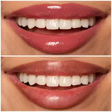 08 DRIPPIN IN ROSE shade of Lip I.V. Hydrating Lip Gloss Stain for both shine and stain.